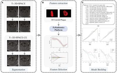 Identifying vulnerable plaques: A 3D carotid plaque radiomics model based on HRMRI